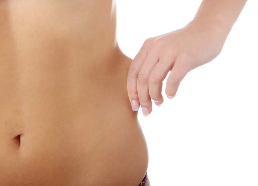 2 procedimentos não invasivos para tratar flacidez que surge após a cirurgia bariátrica