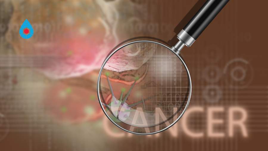 Quais as causas do câncer?