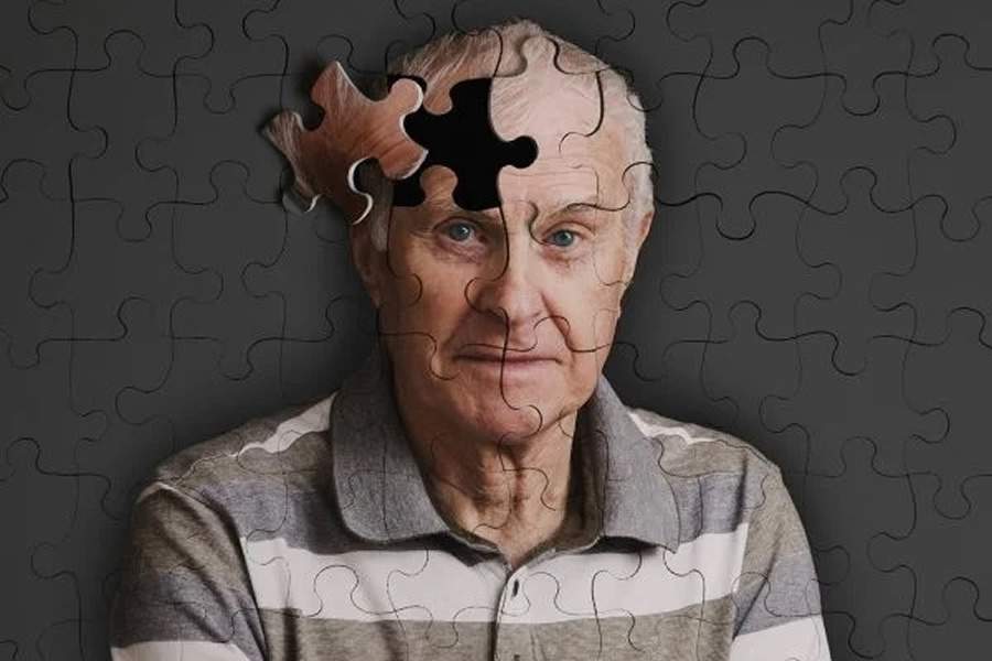 Cientistas desenvolvem novo exame para diagn&oacute;stico mais preciso de Alzheimer