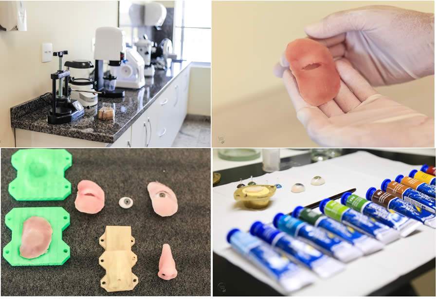 Laborat&oacute;rio produz pr&oacute;teses gratuitas para pacientes oncol&oacute;gicos