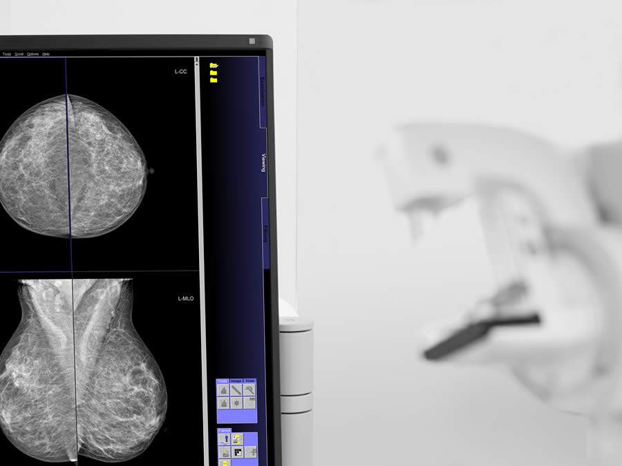 Mam&oacute;grafo 2 (Divulga&ccedil;&atilde;o Siemens)