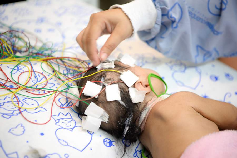 O eletroenc&eacute;falograma &eacute; um dos exames que ajuda no diagn&oacute;stico da epilepsia / Foto: Camila Hampf
