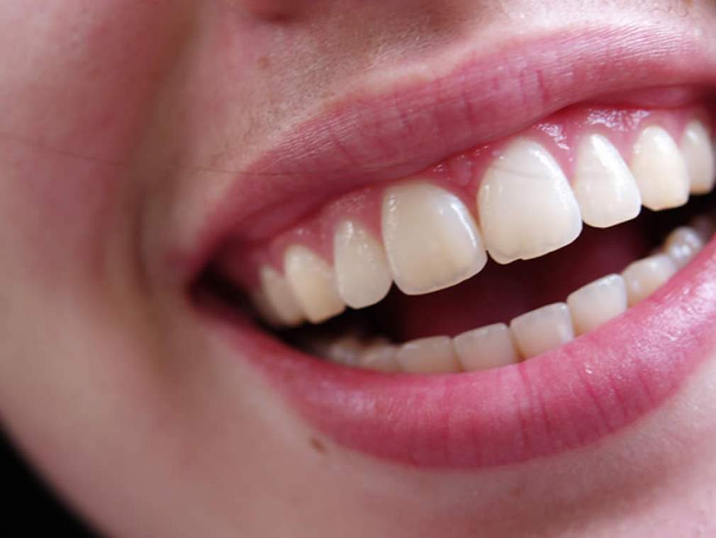 Dia Mundial do Sorriso: 9 dicas para manter a saúde oral em dia e conquistar um sorriso bonito