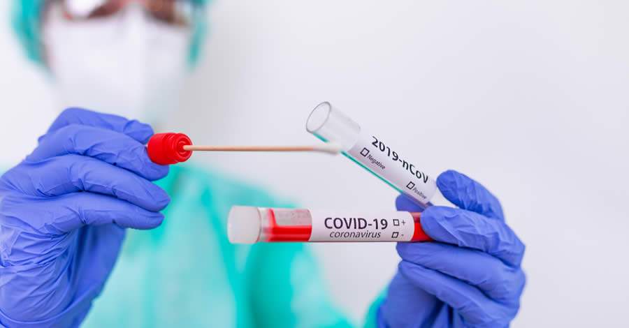 Com mais de 10,2 milhões de testes de COVID-19 em 2020, setor privado foi responsável por 43,1% de todo o diagnóstico do país
