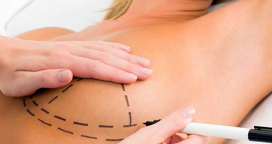 Dicas para planejar sua cirurgia pl&aacute;stica em 2021