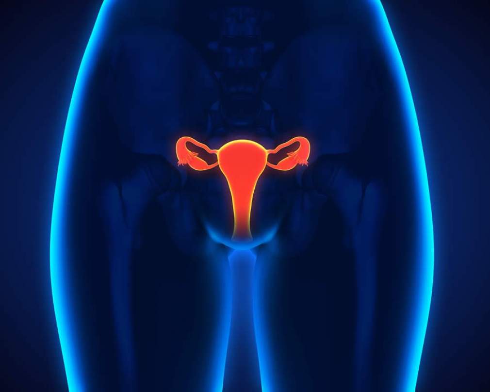 Endometriose e a fertilidade