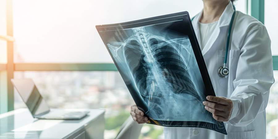 Pode n&atilde;o ser Covid! Diagn&oacute;sticos distintos de quadros pulmonares