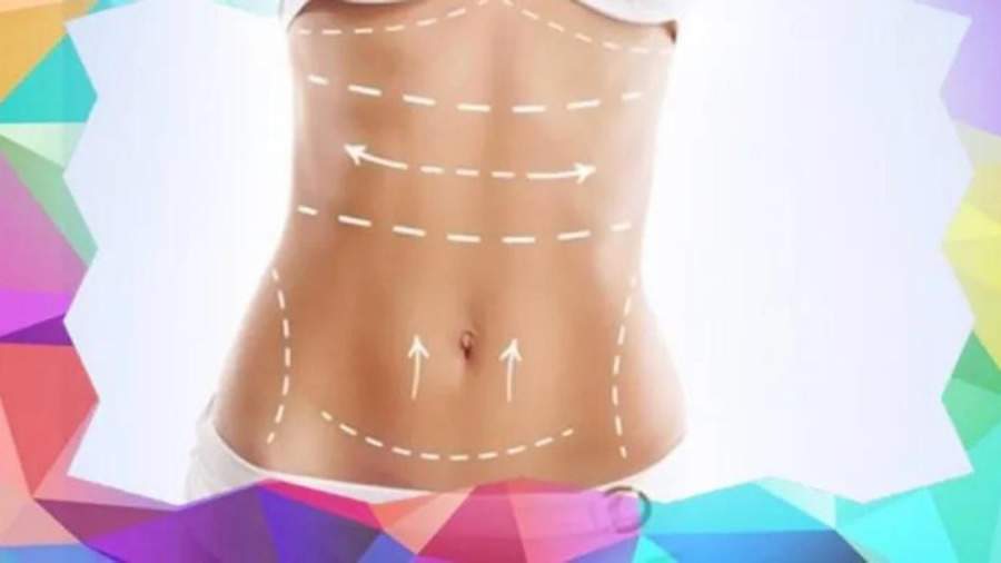 Ainda d&aacute; tempo de realizar cirurgias pl&aacute;sticas antes do desfile de Carnaval? M&eacute;dico especialista d&aacute; dicas e fala da recupera&ccedil;&atilde;o