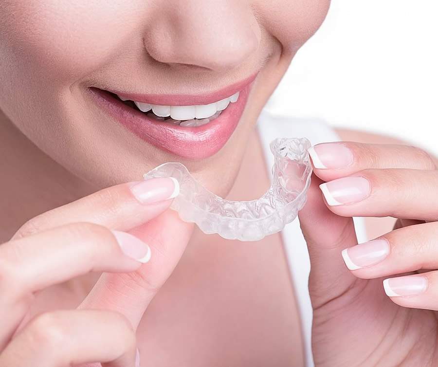 Alinhadores, o futuro da ortodontia - Divulga&ccedil;&atilde;o